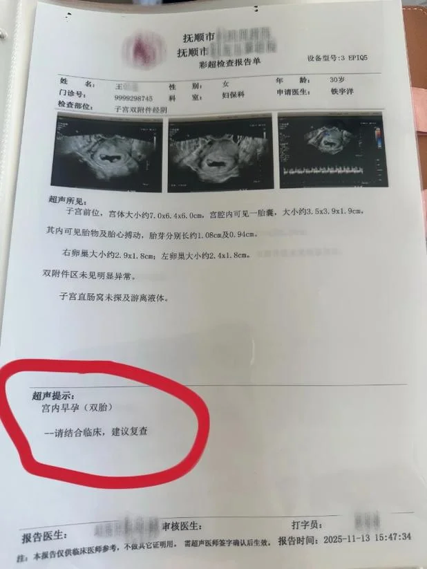 孕妇梦到产检结果不好_1