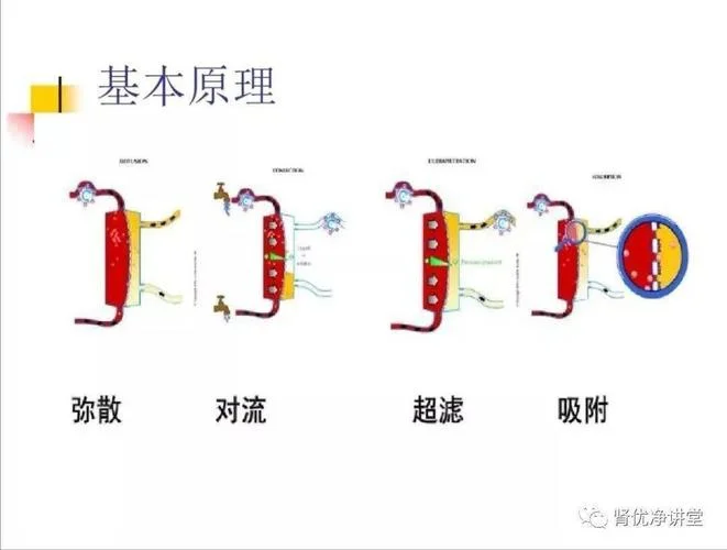 血透是什么原理-血液透析原理