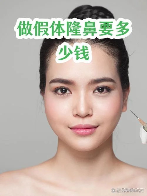 去假体隆鼻多少钱_1