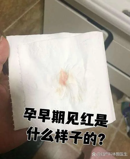 梦见别人生孩子见红_1