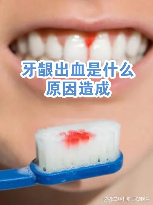 梦见刷牙出血周公解梦_1