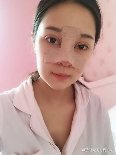 整容分期需要什么条件-美容整形分期条件