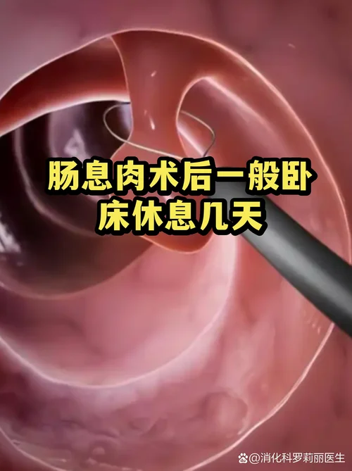 肠息肉手术一般多少钱_1