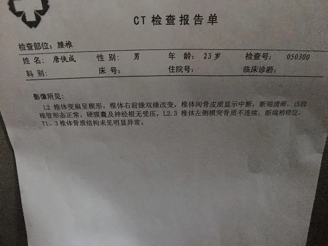 全脊柱ct多少钱_2