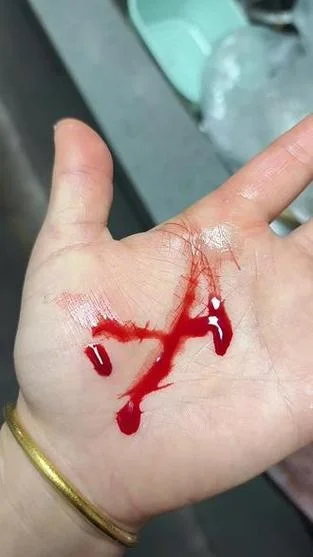 梦见被人捅了一刀出血_2