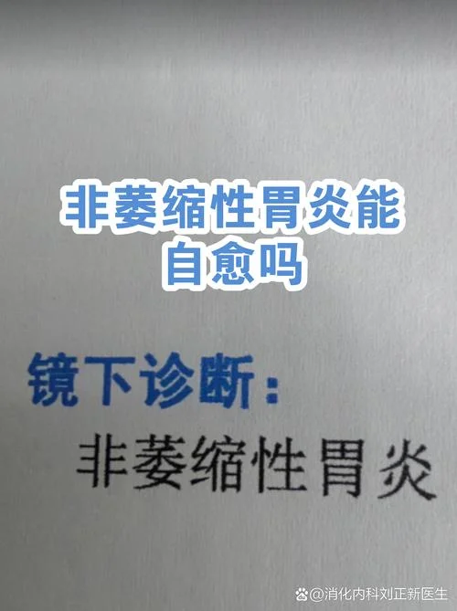 慢性非萎缩性胃炎又叫什么名字_2