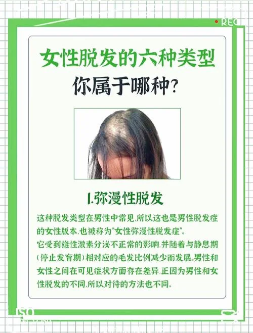 梦到自己生病掉头发_2