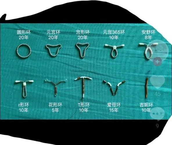 上爱母环多少钱_2