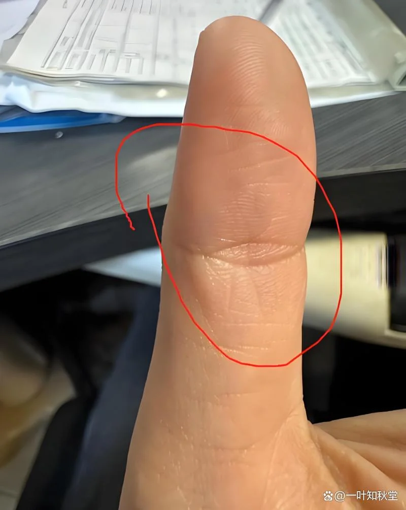 手相道眼纹在手掌_2