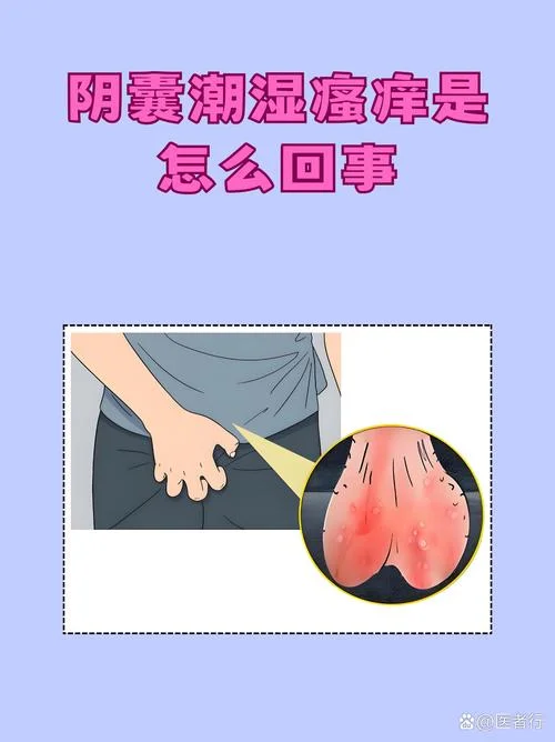 做梦盗汗阴囊潮湿_1