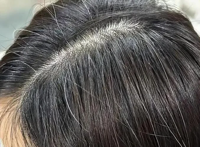 梦见头发白了很多_2