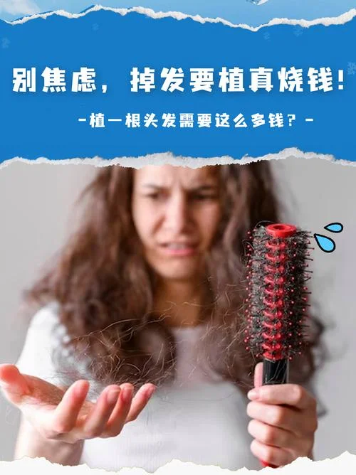 要多少钱头发种植_1