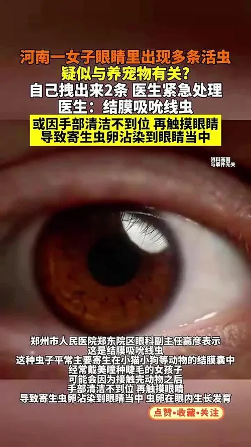 梦见眼睛里有虫子_2