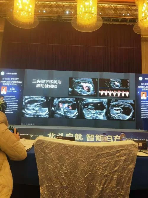 超声主治医师报名条件2018_1