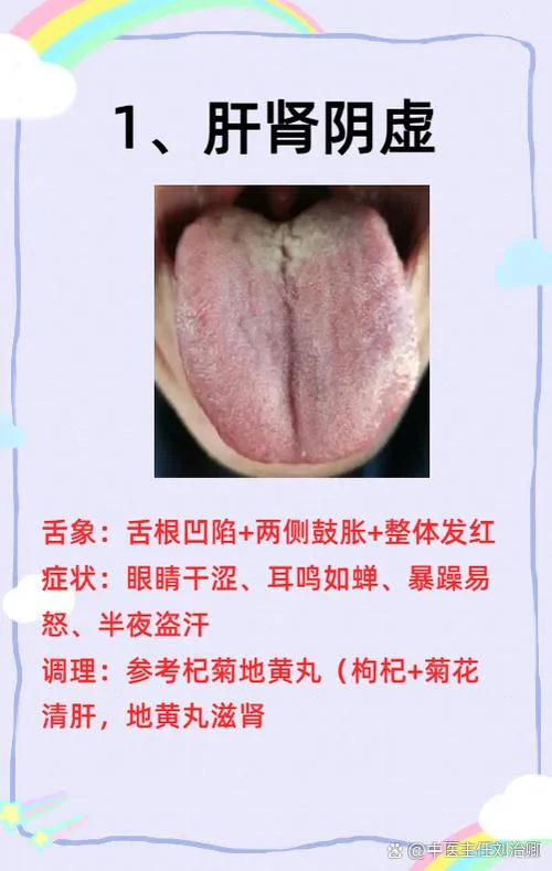 什么是肾虚有什么症状-肾虚症状全解析