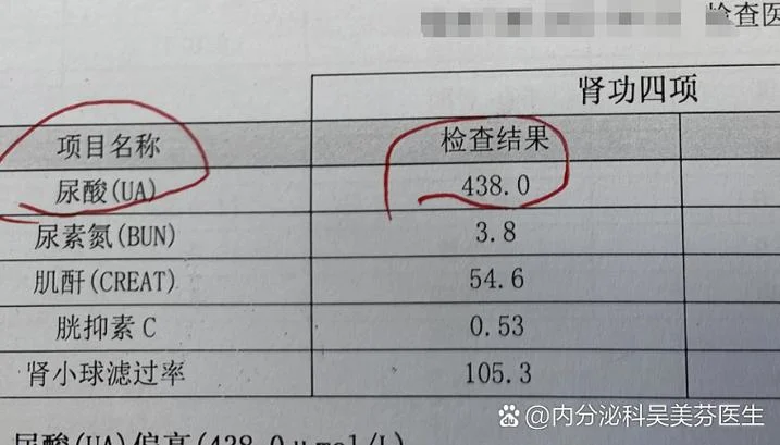 检查血尿酸多少钱_2