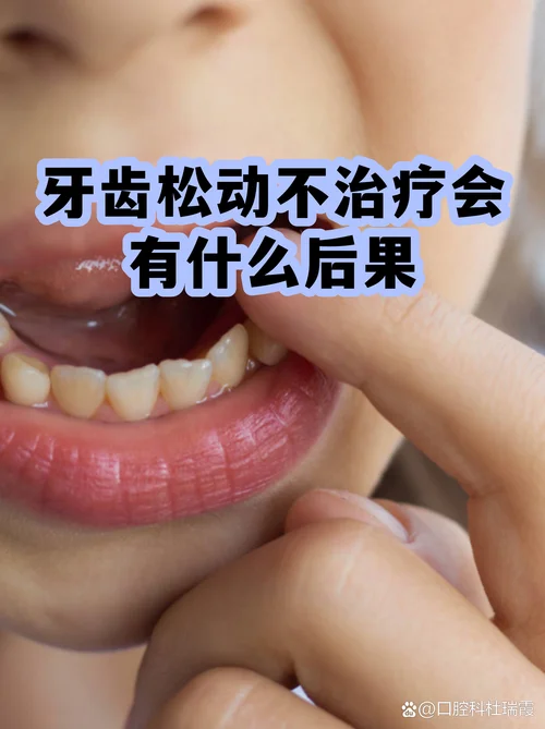 梦见别人牙齿松动是什么征兆-预示人际关系或焦虑