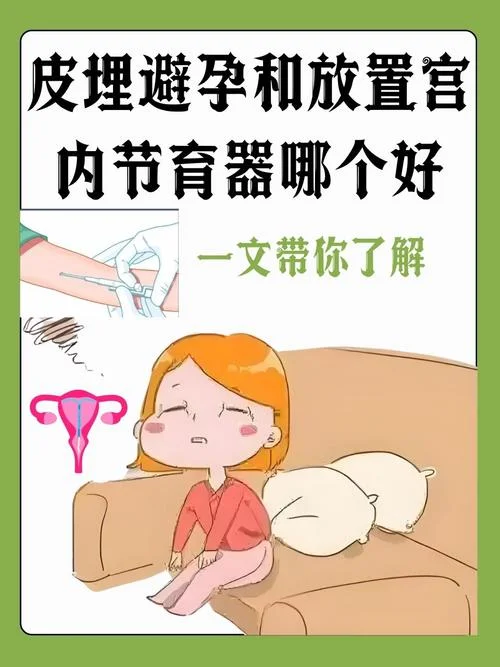 埋线避孕是什么原理_1