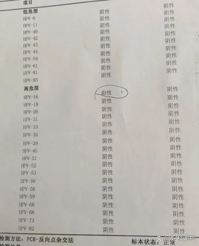 什么是干扰素使用时间_1