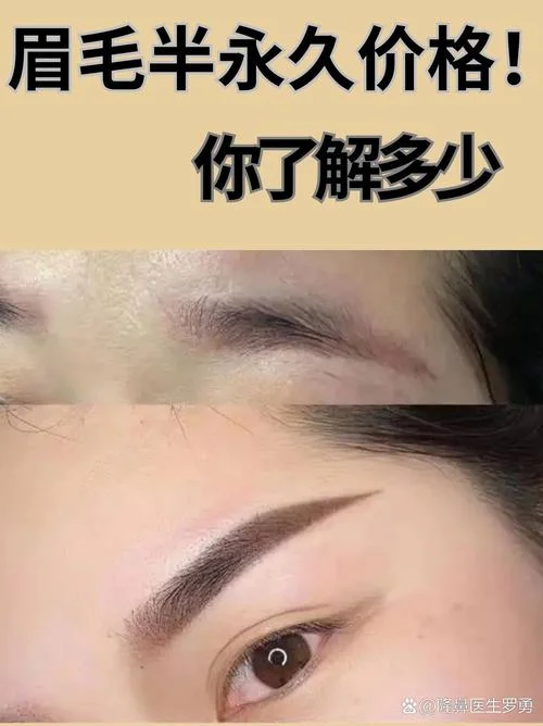 整容眉毛多少钱_1