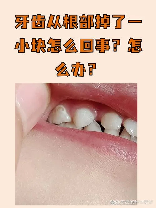 梦见长蛀牙掉了是什么预兆_1
