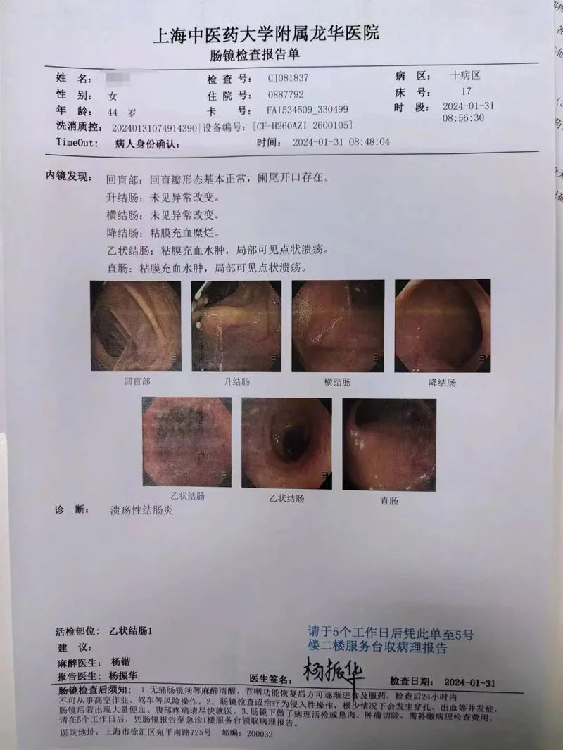 什么是粘膜性结肠炎-什么是粘膜性结肠炎