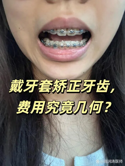 单颗牙齿做牙套多少钱_1