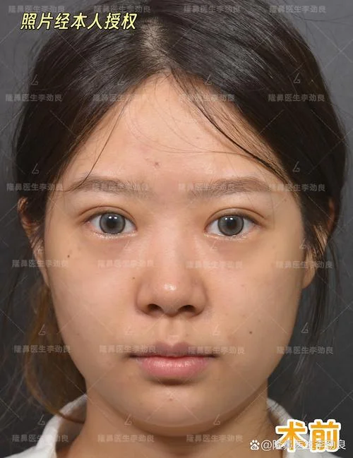 整容证明范本-整容证明范本示例