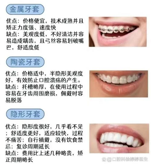门牙矫正一般需要多少钱_2