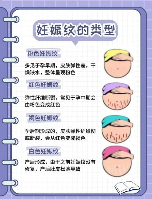 肚子上长妊娠纹怎么办_2
