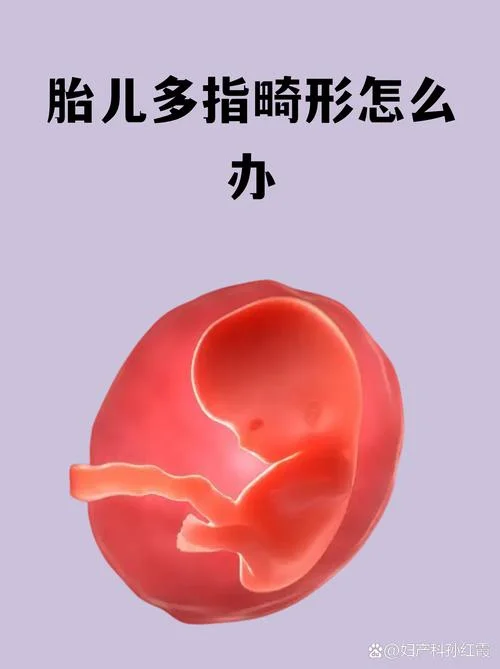 如何筛查胎儿畸形_1
