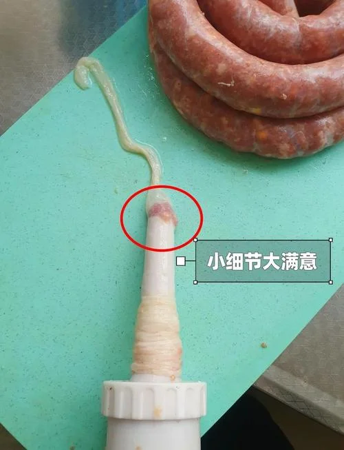 钡灌肠怎么做_1