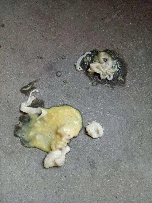 梦见粪水蛆虫_2