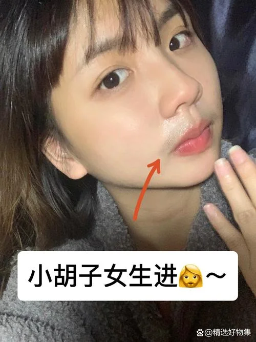 脱唇毛要多少钱_2