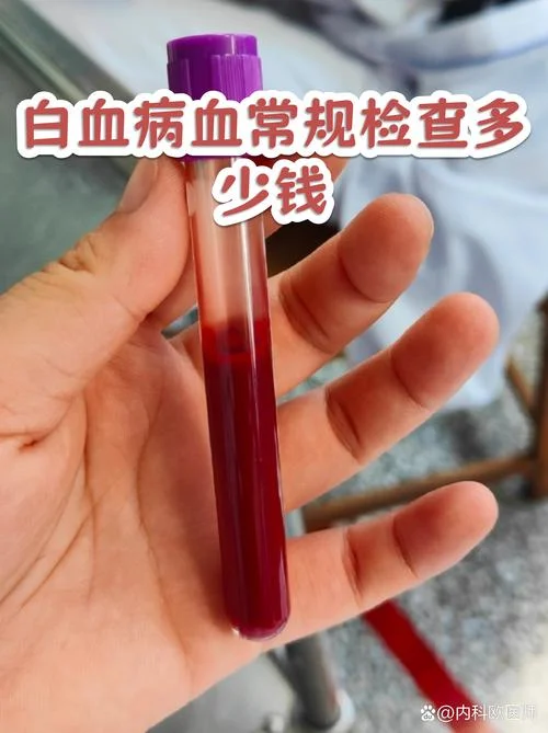 查血一般多少钱?_1