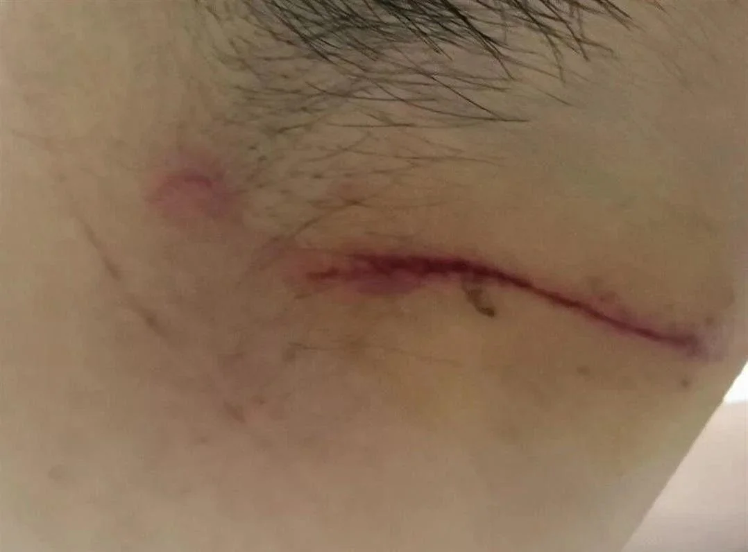 梦见脖子被人砍了一刀_2