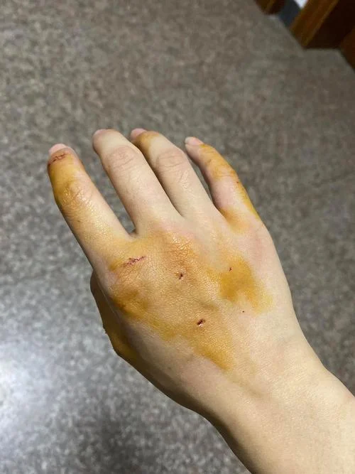 梦见狼咬手_1