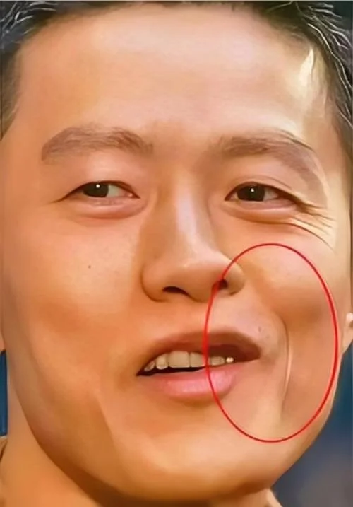 露牙龈的面相男人-露牙龈面相示男人