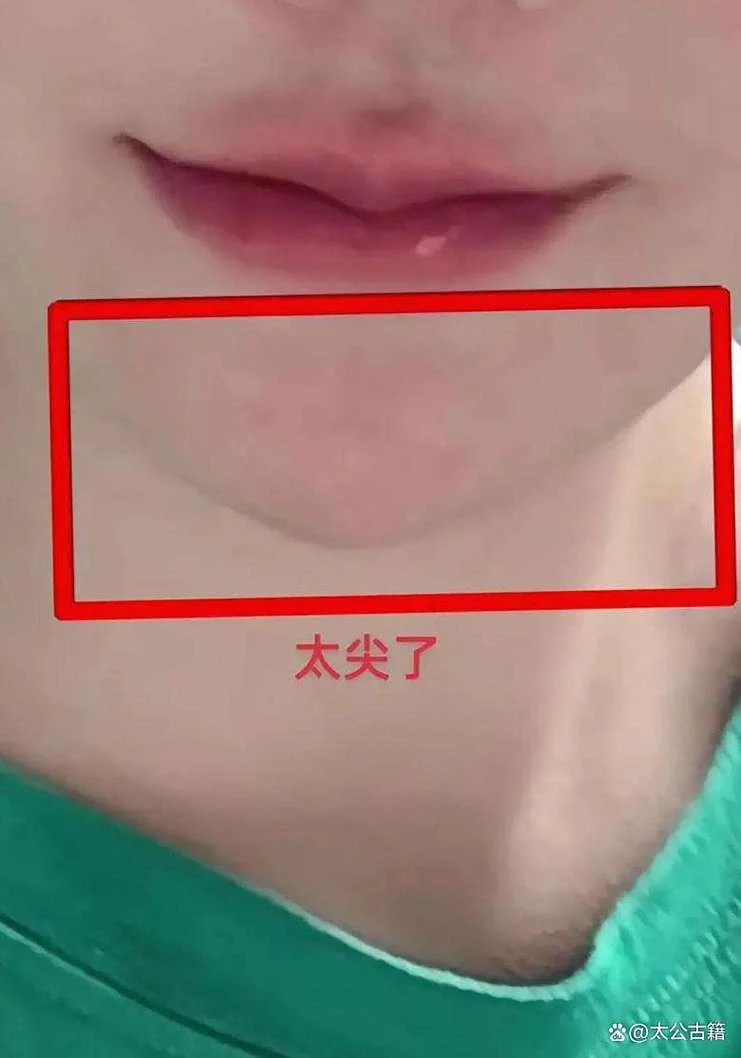 下巴有坑的女人面相-下巴凹者面相