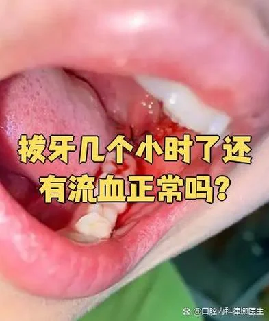 梦见掉了一大把牙齿还有血_1