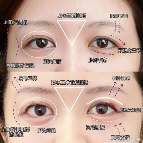 面相眼尾纹图解女人_2