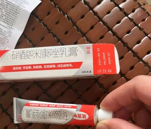 皮肤癣痒买什么药-皮肤癣痒用什么药