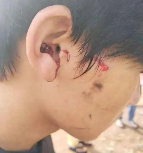 梦见自己耳朵出血_2