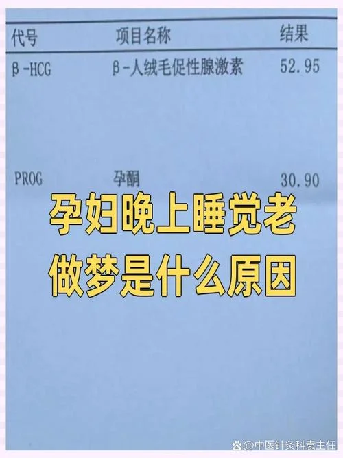 怀孕了老做梦_2