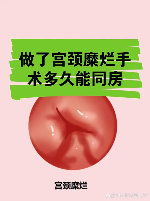 宫颈糜烂微创手术多少钱_1