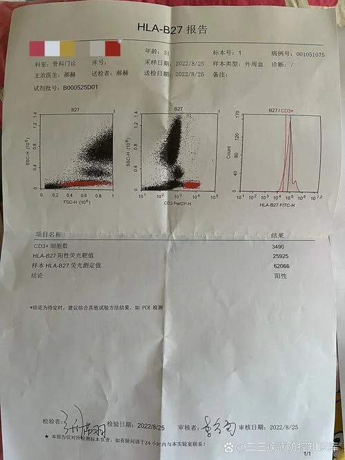 全脊柱ct多少钱_1