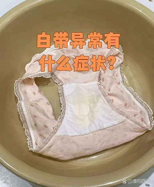什么图片是白带-什么图片是白带