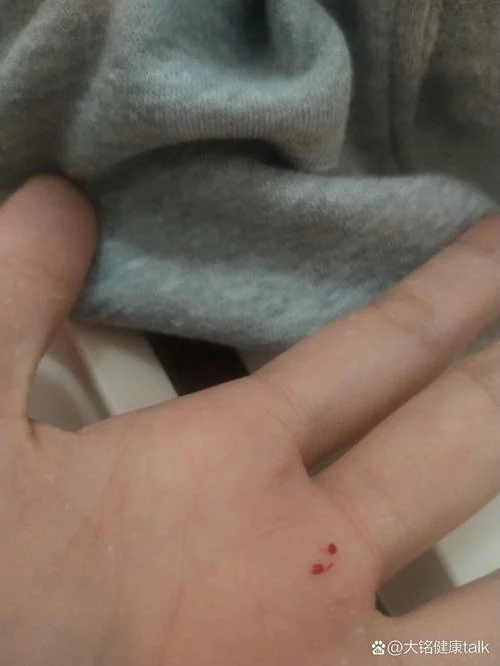 梦见老鼠咬自己的身体_1