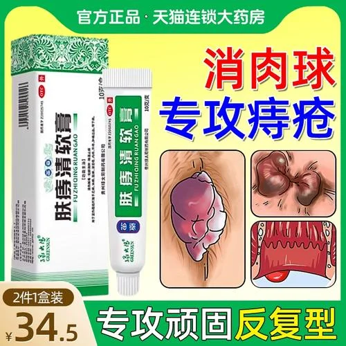 外痔买什么药比较好_2