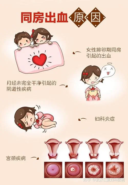 刺激性出血是宫颈什么问题_1